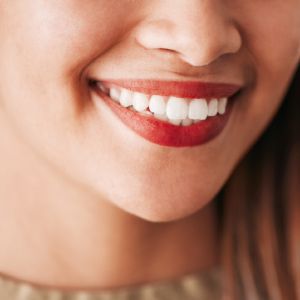Post-Treatment Dos & Don’ts of Teeth Whitening in Sacramento