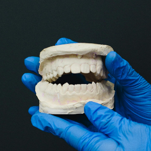 Exploring the Pros and Cons of Dentures in Sacramento