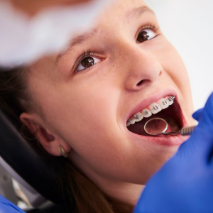 How Braces in Sacramento Can Improve Your Oral Health