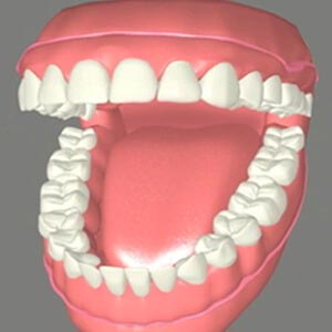 Types of Dentures in Sacramento: Which One is Right for You?